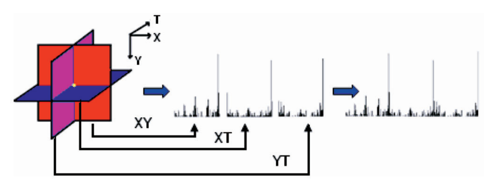 LBP-TOP Processing Flow